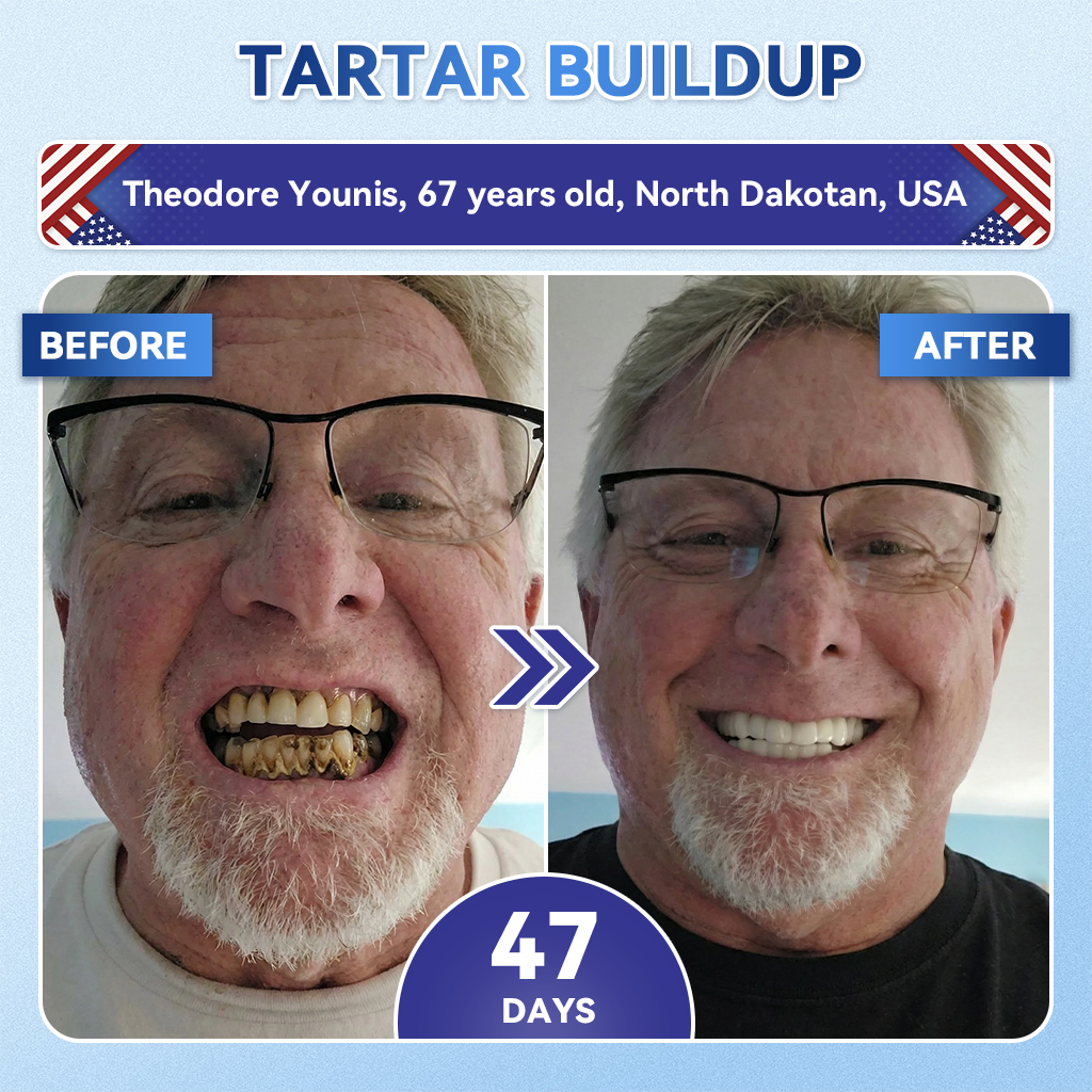GаrаgеLіnе® 🦷 Tideglusib Fast‑Dissolving Tooth & Gum Repair Oral Strips ✨ (Supports tooth repair and helps relieve gum discomfort and other common oral concerns)