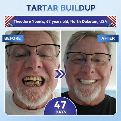 GаrаgеLіnе® 🦷 Tideglusib Fast‑Dissolving Tooth & Gum Repair Oral Strips ✨ (Supports tooth repair and helps relieve gum discomfort and other common oral concerns)