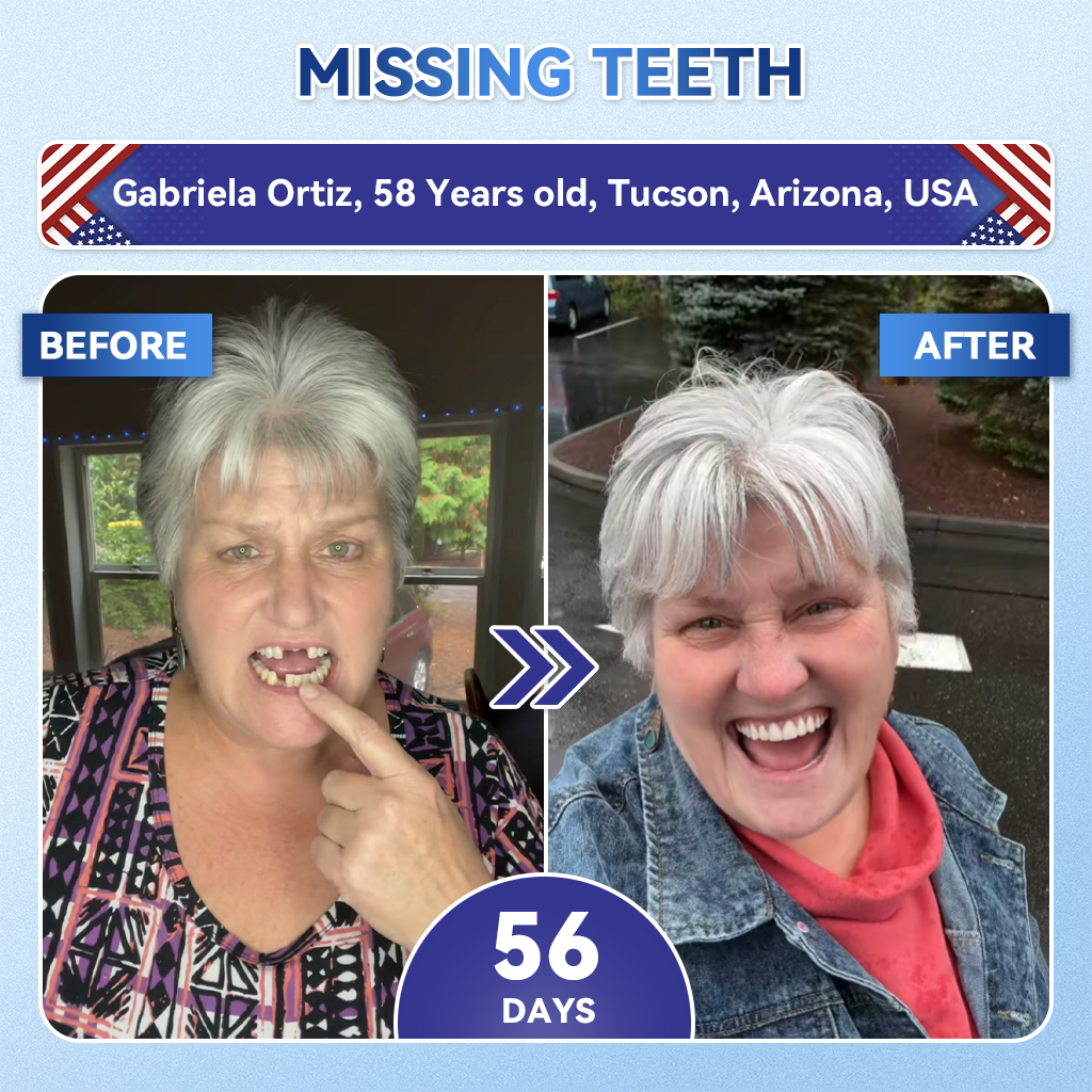 GаrаgеLіnе® 🦷 Tideglusib Fast‑Dissolving Tooth & Gum Repair Oral Strips ✨ (Supports tooth repair and helps relieve gum discomfort and other common oral concerns)