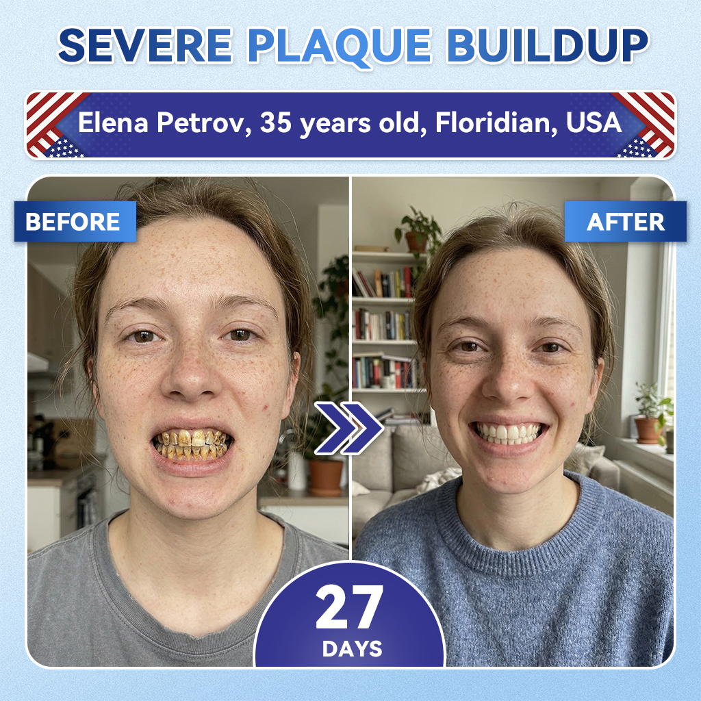 GаrаgеLіnе® 🦷 Tideglusib Fast‑Dissolving Tooth & Gum Repair Oral Strips ✨ (Supports tooth repair and helps relieve gum discomfort and other common oral concerns)