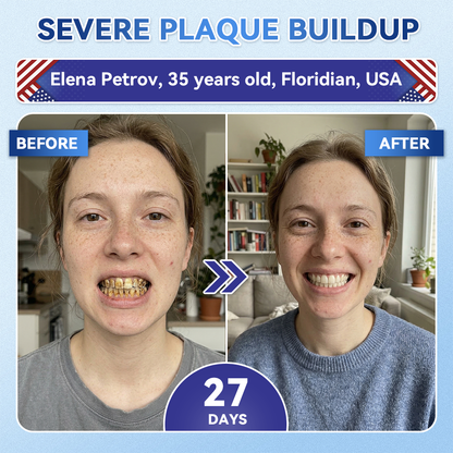 GаrаgеLіnе® 🦷 Tideglusib Fast‑Dissolving Tooth & Gum Repair Oral Strips ✨ (Supports tooth repair and helps relieve gum discomfort and other common oral concerns)