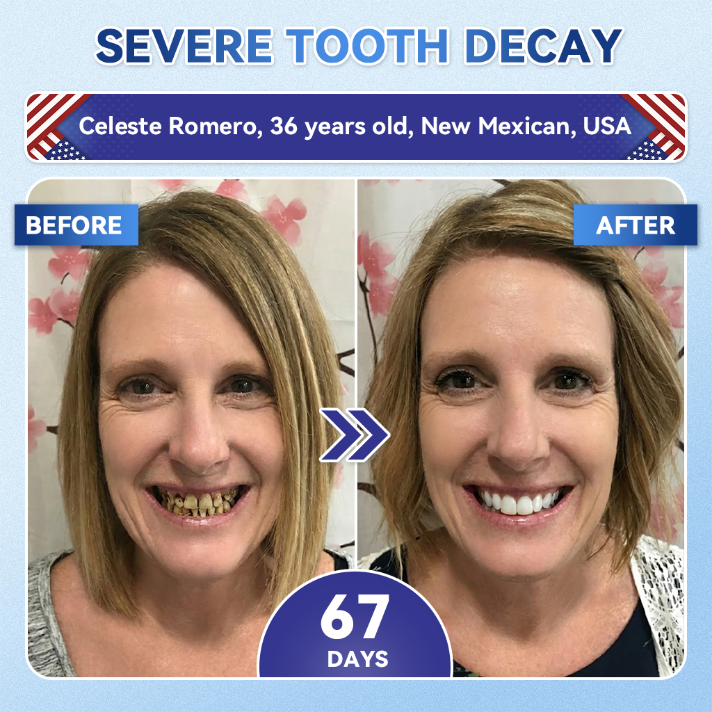 GаrаgеLіnе® 🦷 Tideglusib Fast‑Dissolving Tooth & Gum Repair Oral Strips ✨ (Supports tooth repair and helps relieve gum discomfort and other common oral concerns)
