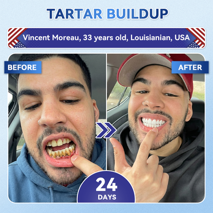 GаrаgеLіnе® 🦷 Tideglusib Fast‑Dissolving Tooth & Gum Repair Oral Strips ✨ (Supports tooth repair and helps relieve gum discomfort and other common oral concerns)
