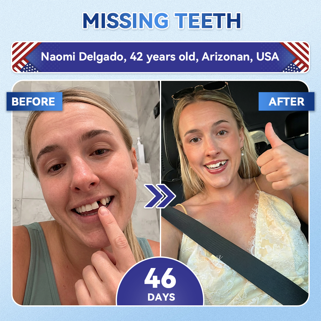 GаrаgеLіnе® 🦷 Tideglusib Fast‑Dissolving Tooth & Gum Repair Oral Strips ✨ (Supports tooth repair and helps relieve gum discomfort and other common oral concerns)