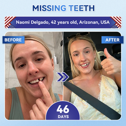 GаrаgеLіnе® 🦷 Tideglusib Fast‑Dissolving Tooth & Gum Repair Oral Strips ✨ (Supports tooth repair and helps relieve gum discomfort and other common oral concerns)
