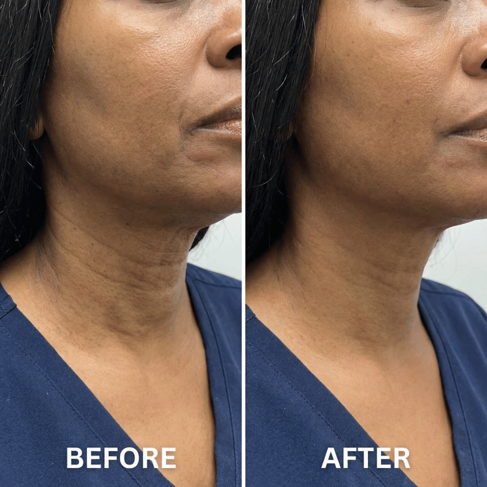 Anti-Cellulite Massage Oil